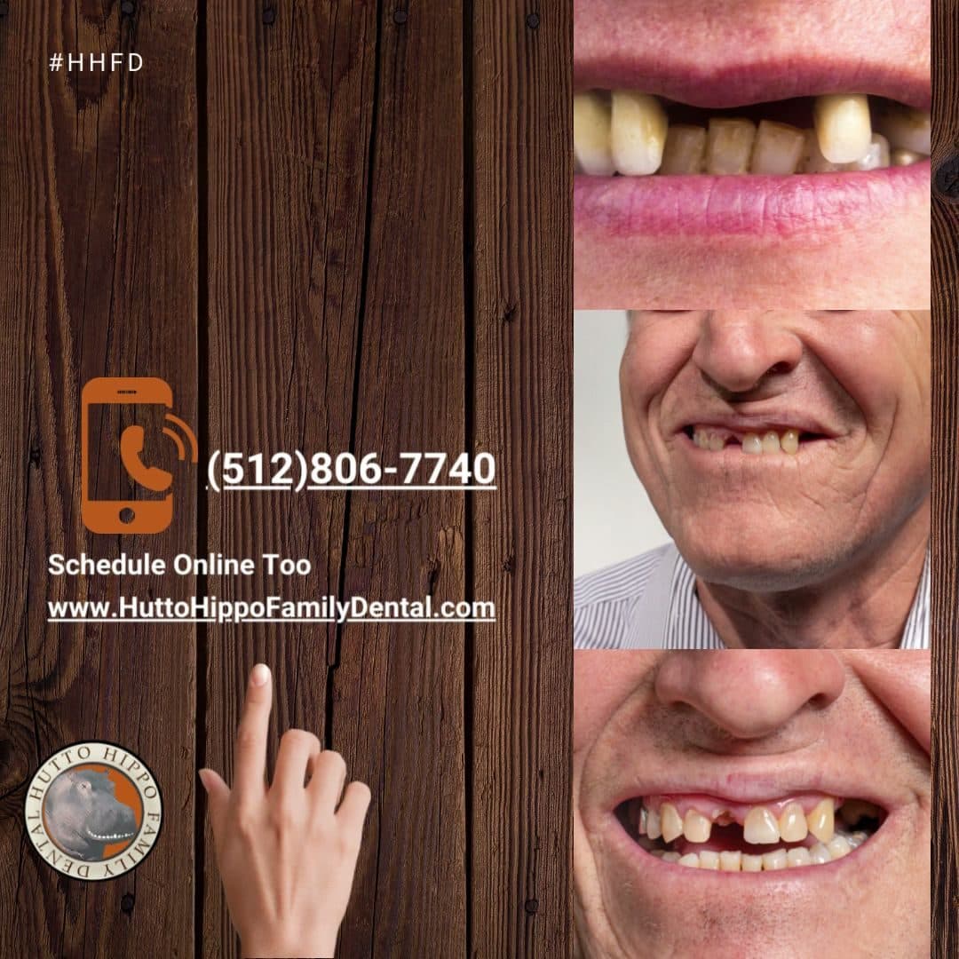 Hutto Hippo Family Dental — Dentists photo 1 of 5