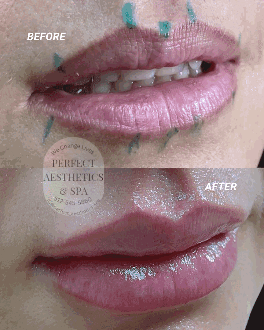 Perfect Aesthetics & Spa — Med Spas & Aesthetics photo 2 of 5