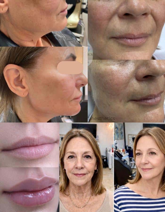 Perfect Aesthetics & Spa — Med Spas & Aesthetics photo 1 of 5