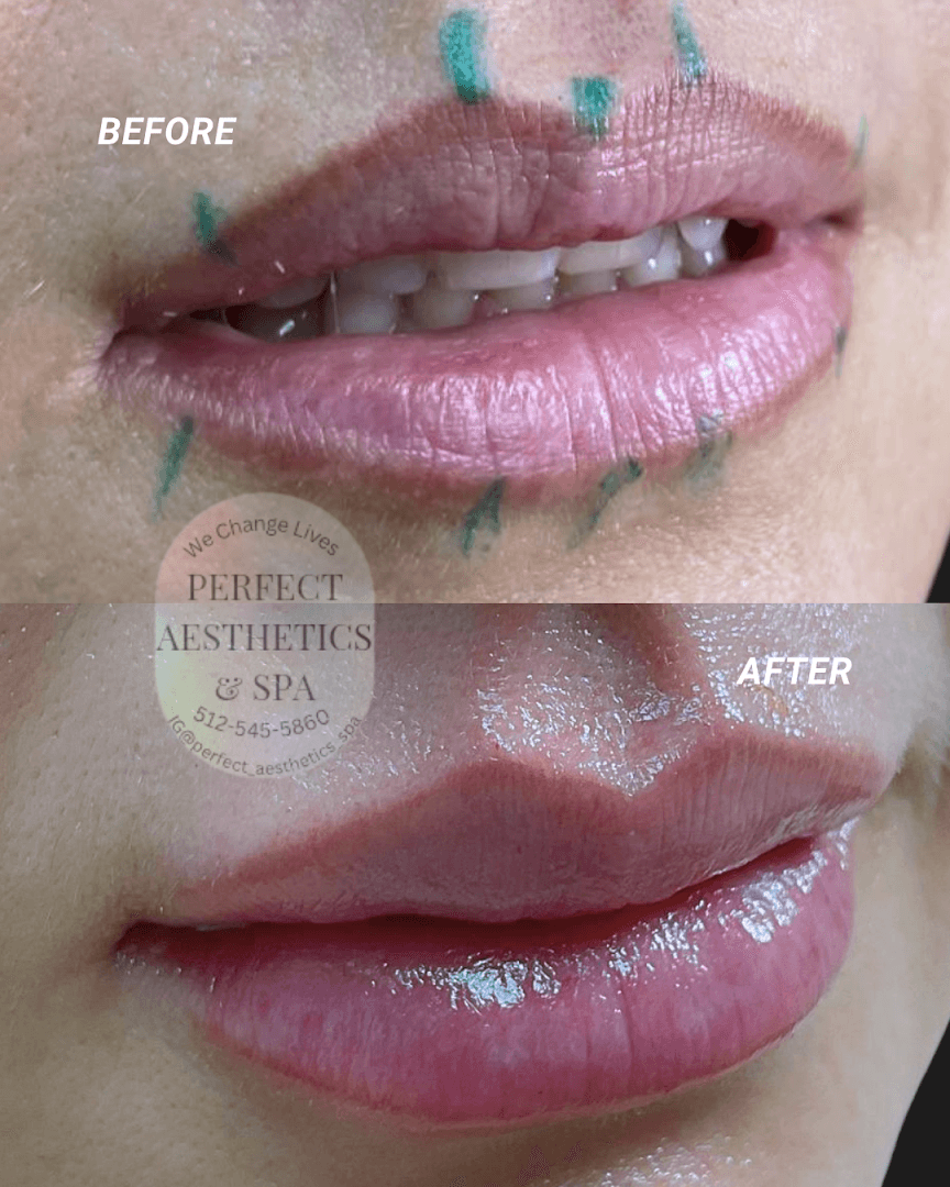 Perfect Aesthetics & Spa — Med Spas & Aesthetics photo 2 of 5