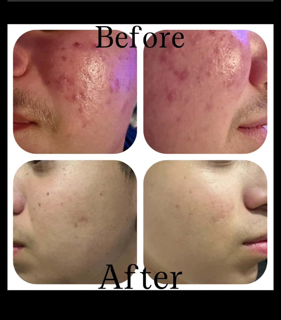 Bespoke Medical Aesthetics & Wellness — Med Spas & Aesthetics photo 2 of 5