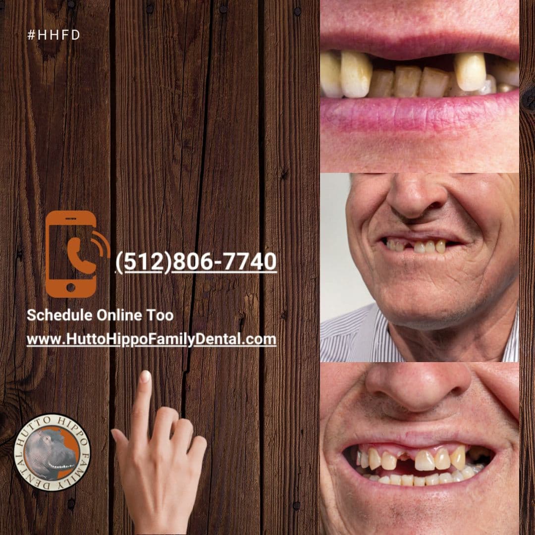 Hutto Hippo Family Dental — Dentists photo 1 of 5